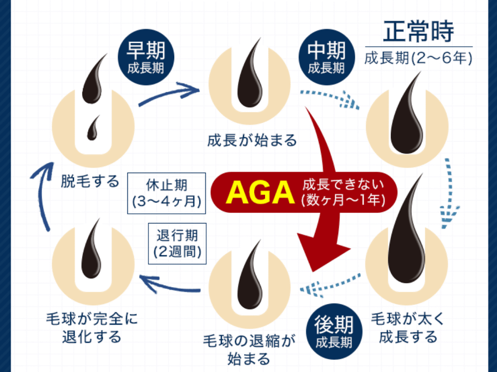 AGAスキンクリニック　事前防衛