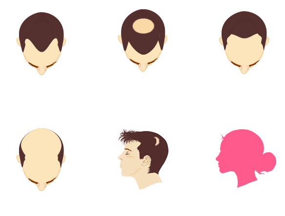親和クリニック 仕上がり